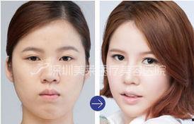 深圳明星网红整形医院