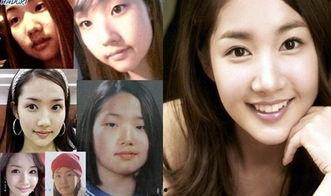 整容的明星网红有哪些,揭秘那些改变容貌的璀璨身影